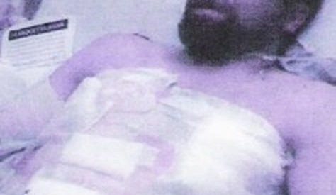 Black ex-cop shot 28 times by White cops is found guilty, fights for justice Black ex-cop shot 28 times by White cops is found guilty, fights for justice