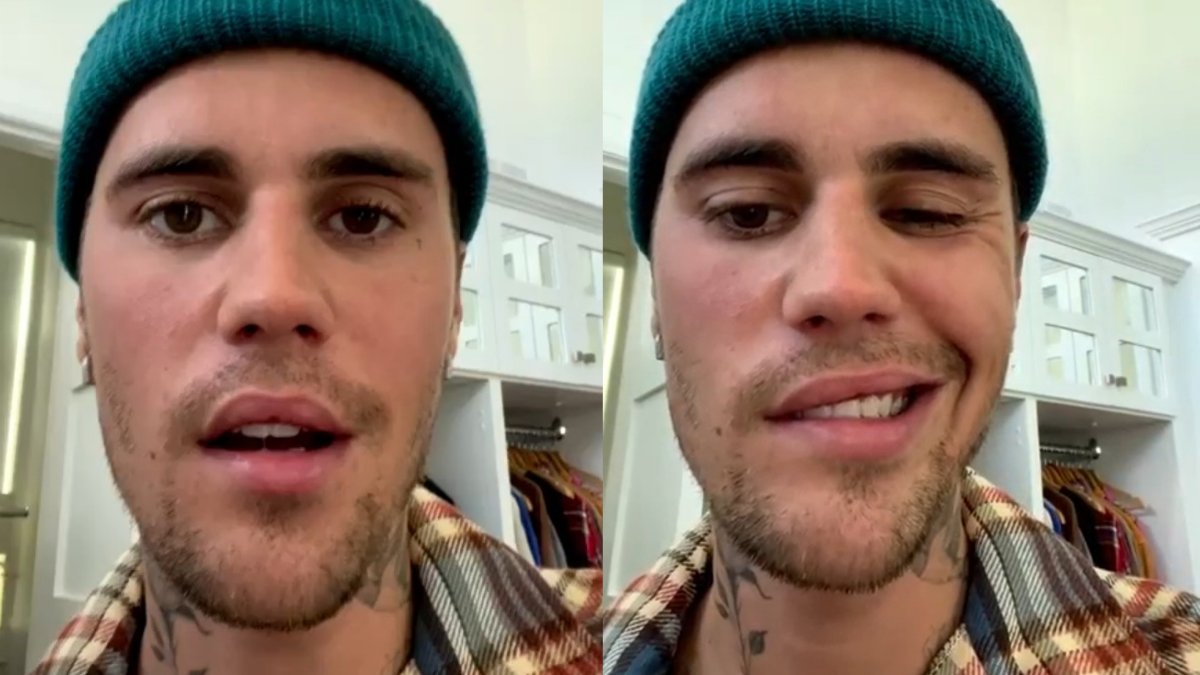 Justin Bieber’s Right-Side Of Face Is Paralyzed – YARDHYPE