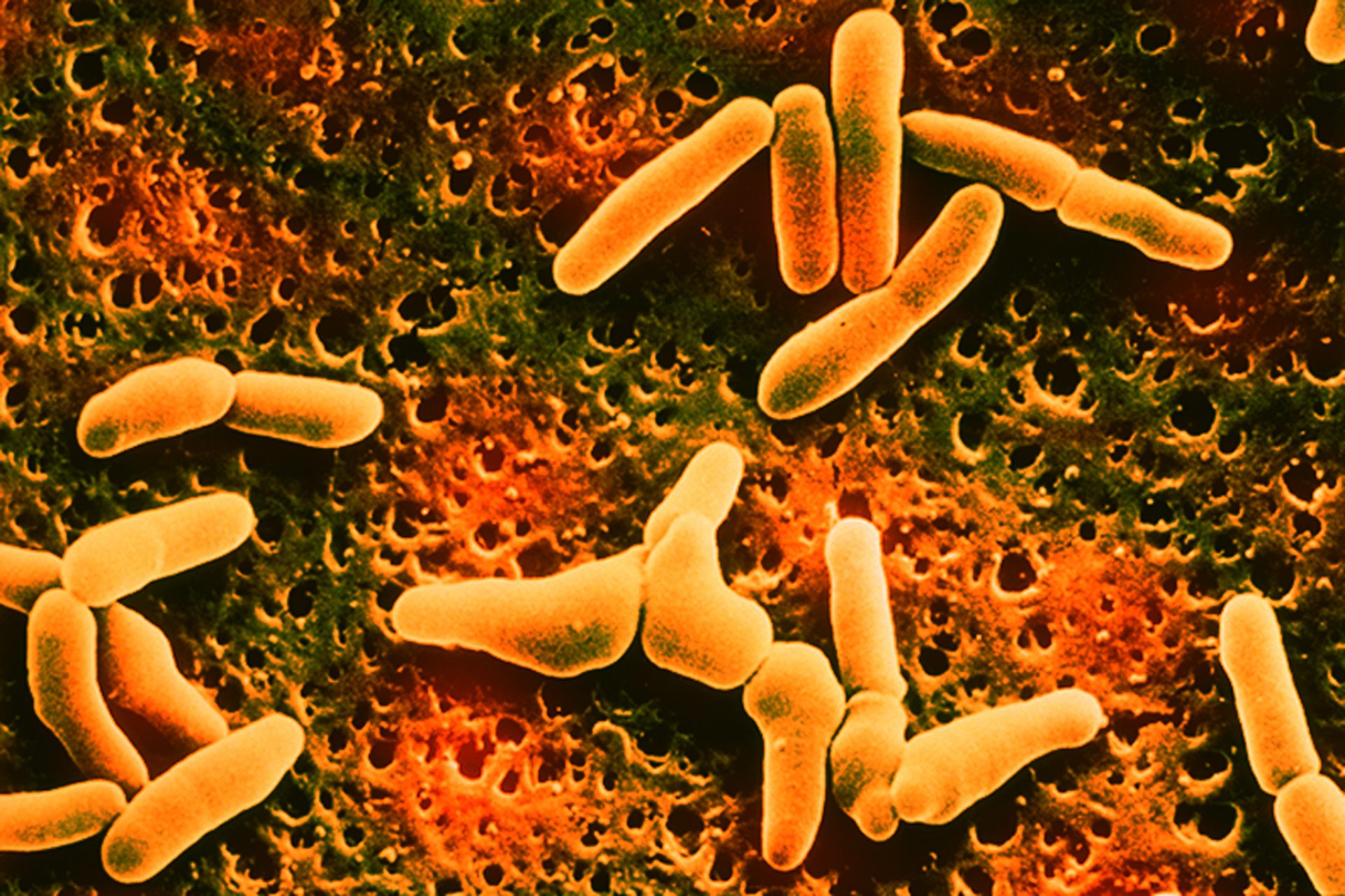 Recent Listeria Outbreak Leaves One Person Dead And 22 Hospitalized With Most Cases Originating In Florida