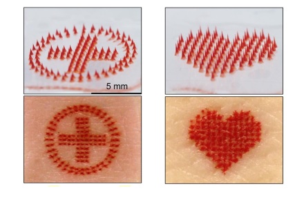 Tattooing could be pain-free thanks to new needle tech